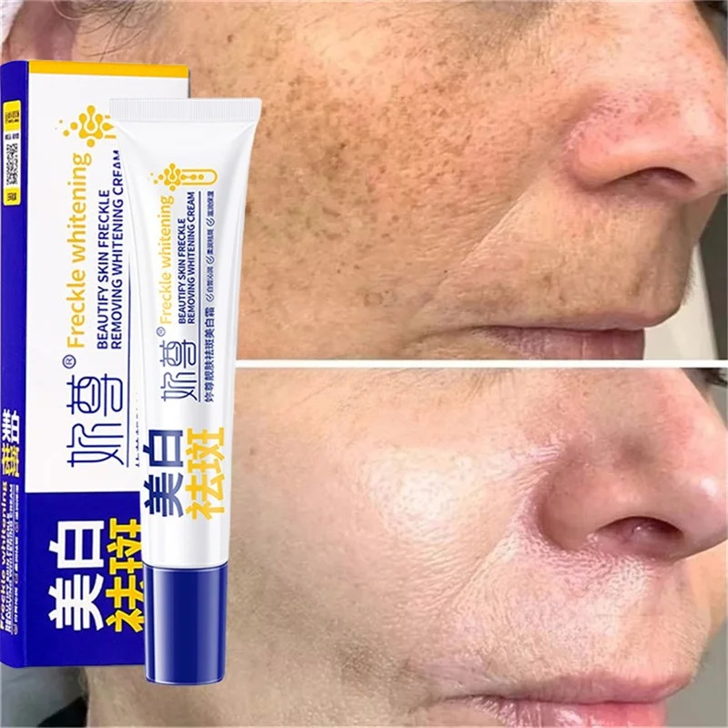 Crème blanchissante puissante  - Skincare Whitening avis et prix