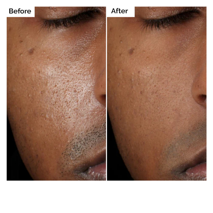 Sérum Solution Aloe 2% + NAG 2 - Aha Bha Exfoliant avis et prix