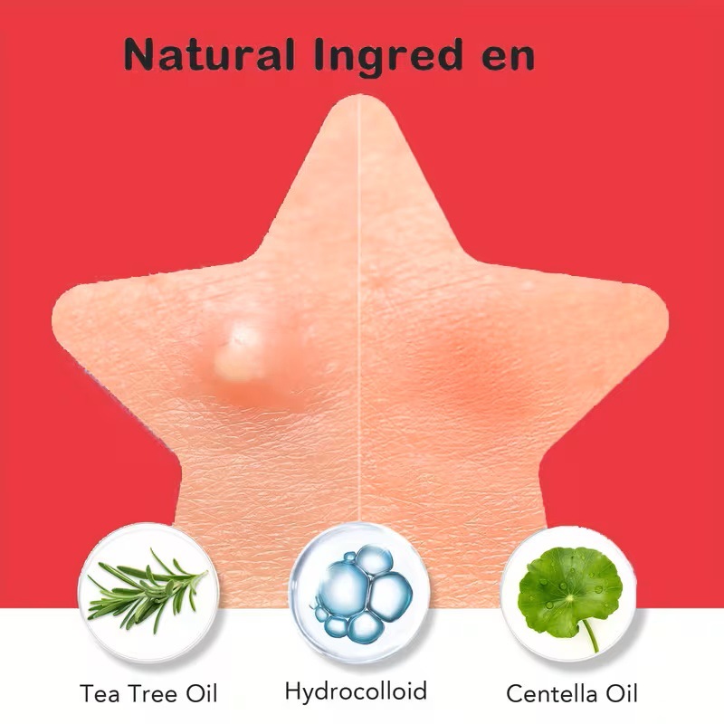 200/400 Patchs anti-acné pour  - Skincare Oil Control avis et prix