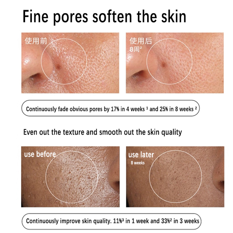 Sérum Solution Aloe 2% + NAG 2 - Aha Bha Exfoliant avis et prix
