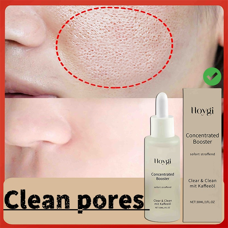 Sérum pour nettoyer les Pores  - Skincare Oil Control avis et prix