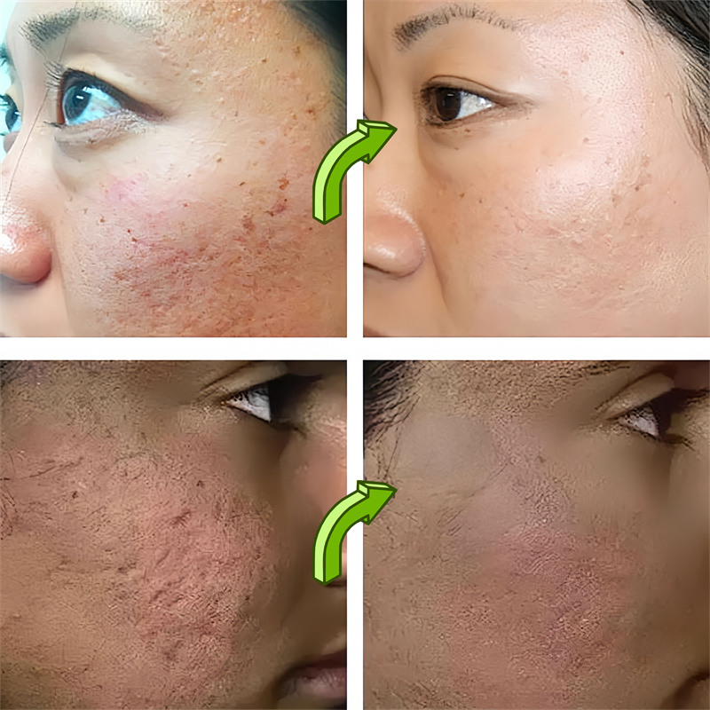 Sérum pour nettoyer les Pores  - Skincare Oil Control avis et prix