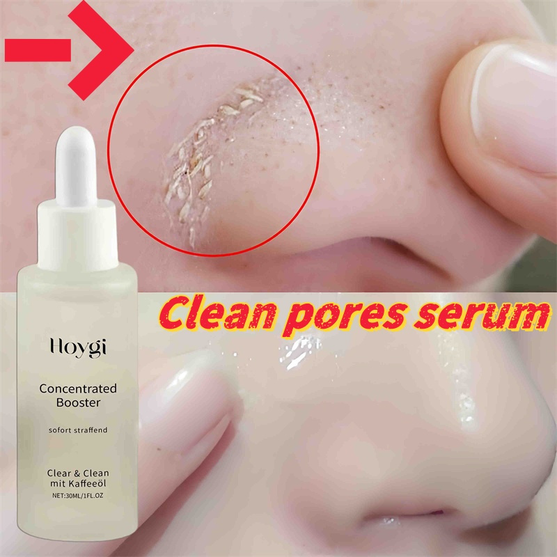 Sérum pour nettoyer les Pores  - Skincare Oil Control avis et prix