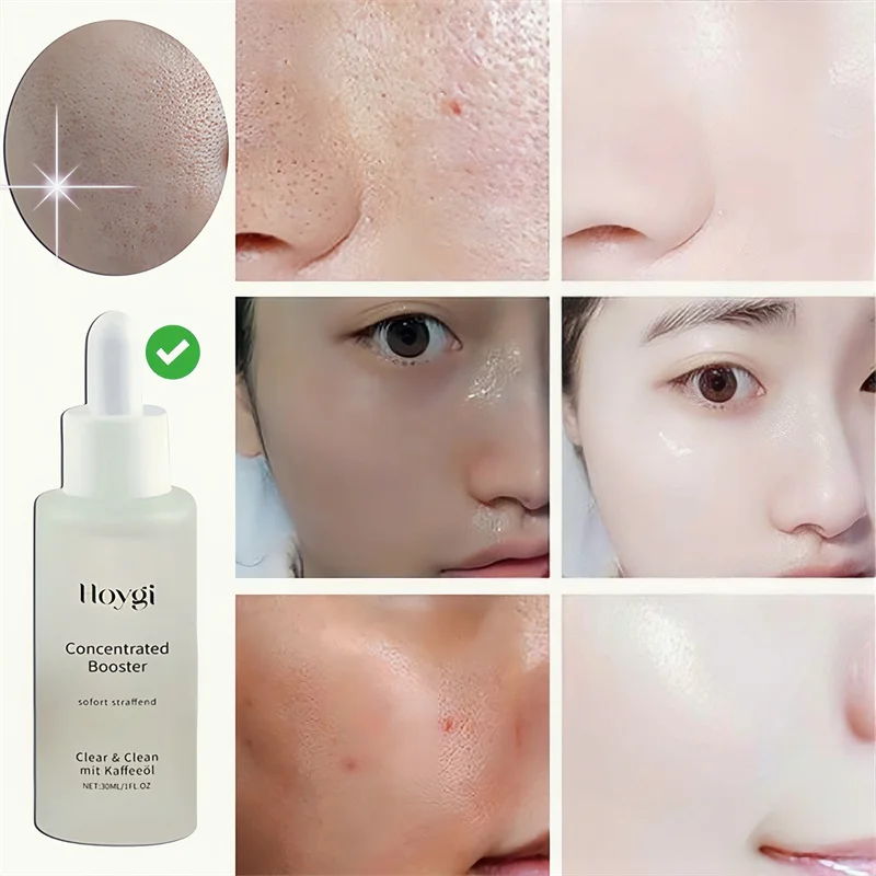 Sérum pour nettoyer les Pores  - Skincare Oil Control avis et prix